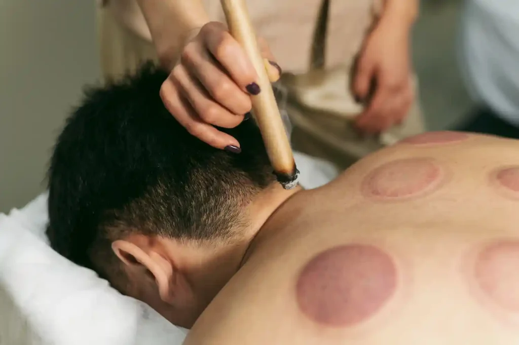 一名中医师正在为患者进行传统的艾灸疗法，用于解释什么是灸疗。