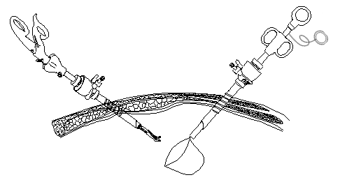 一次性使用内窥镜用活检袋注册审查 - 展开活检袋示意图