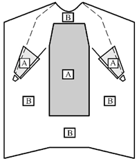 图1：一次性使用手术衣关键区域(A)和非关键区域(B)图示
