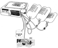 压力控制型腹膜透析设备工作原理示意图 腹膜透析设备注册