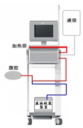 重力控制型腹膜透析设备工作原理示意图 腹膜透析设备注册