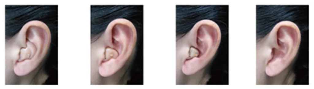 图4 不同的助听器佩戴效果图 助听器注册