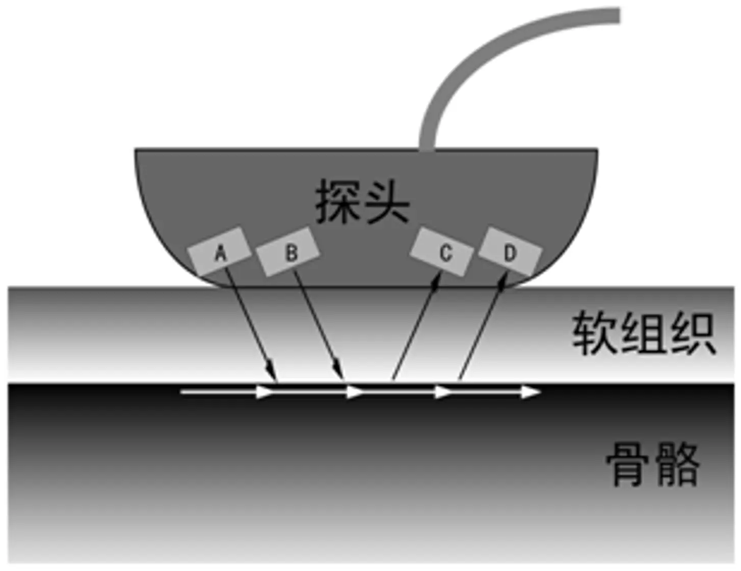 超声骨密度仪注册胫骨桡骨测量原理图