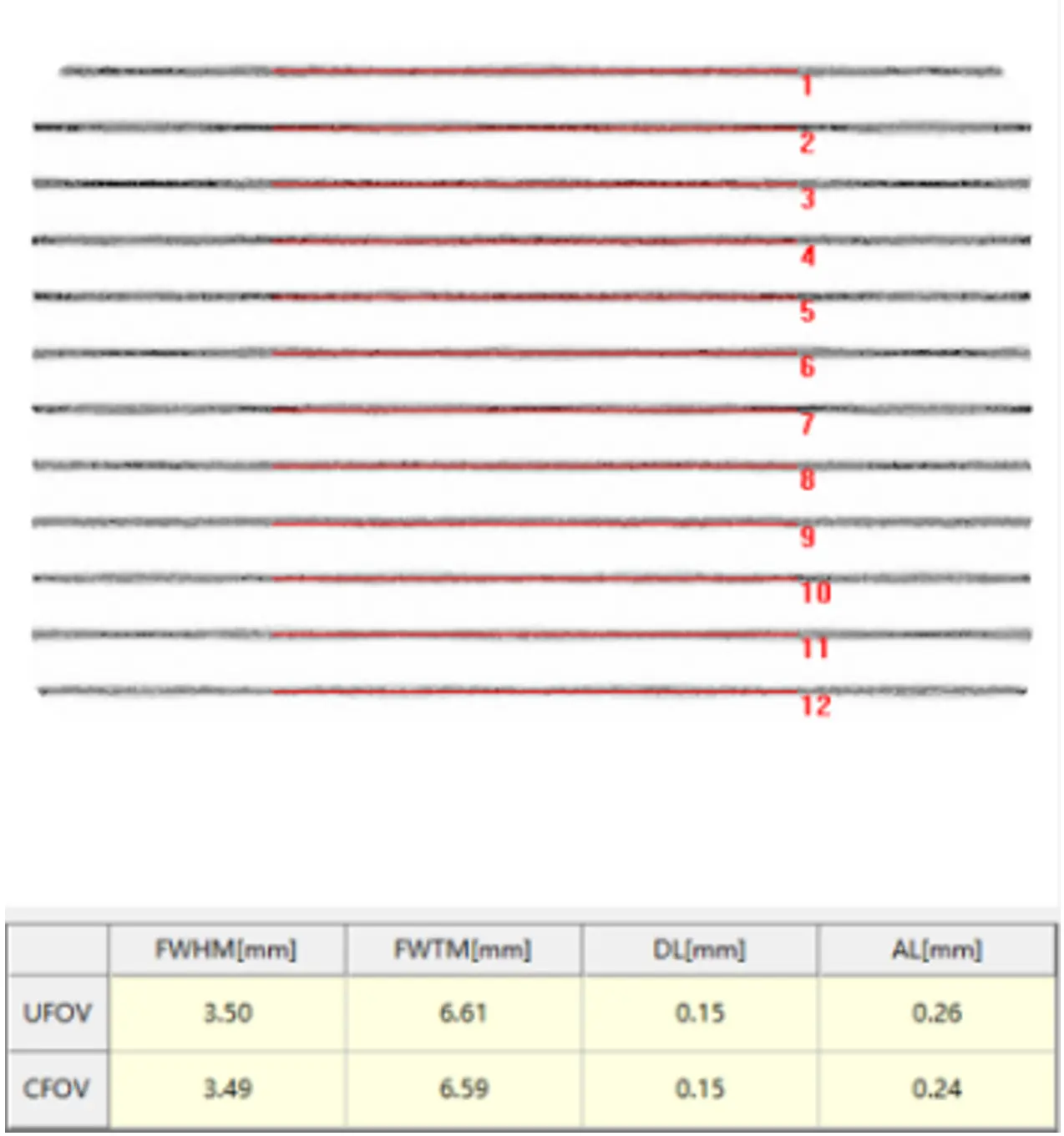单光子发射X射线计算机断层成像系统注册-固有空间分辨率及线性采集模型图像示例