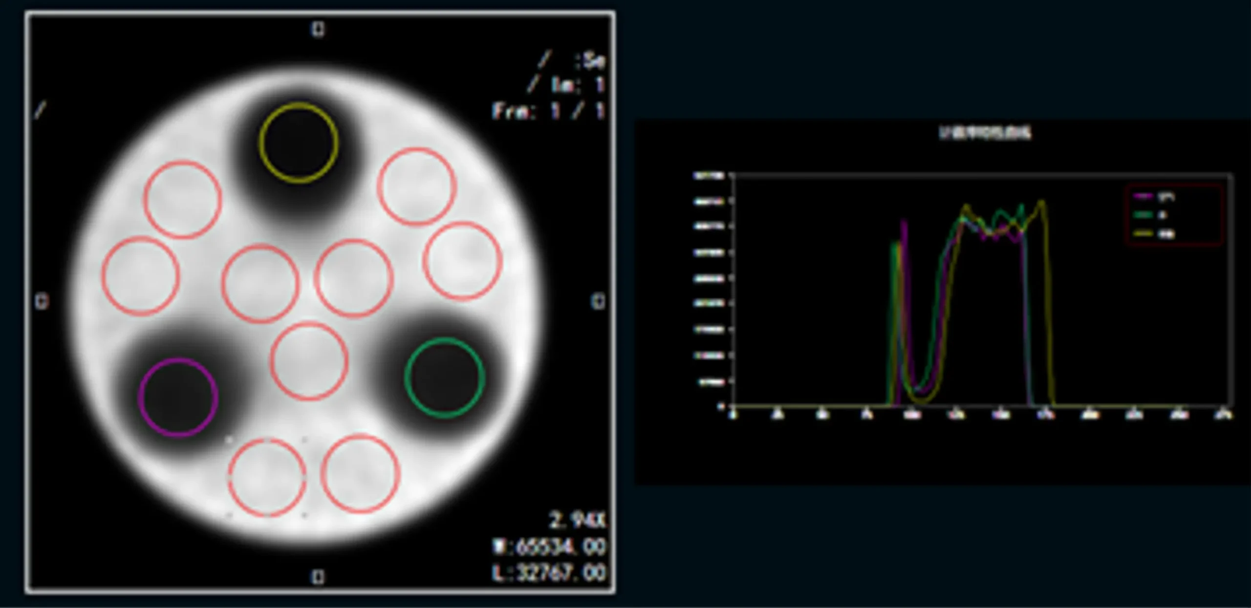 单光子发射X射线计算机断层成像系统注册-衰减校正示示例