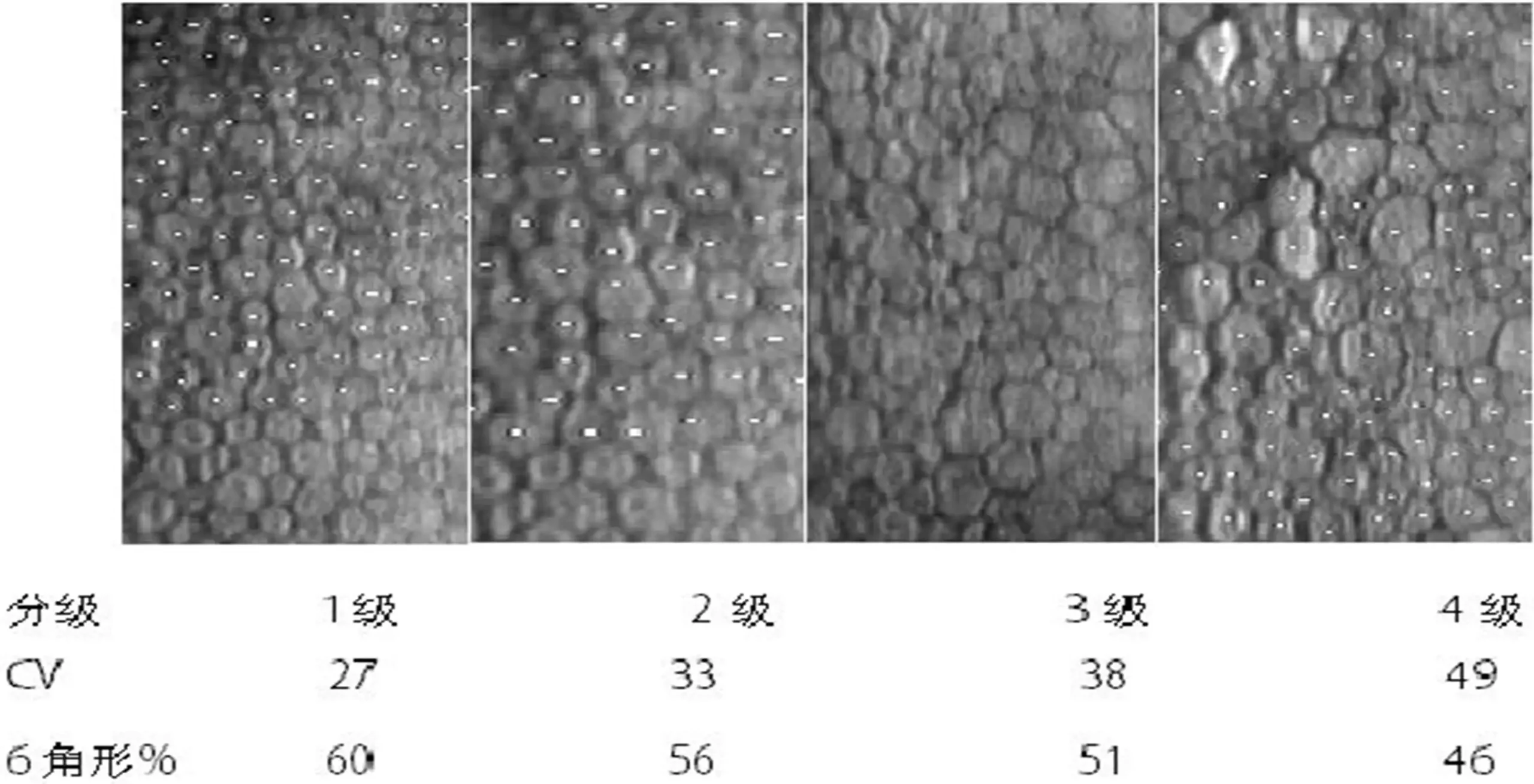 软性接触镜临床评价 - 角膜内皮细胞多形性改变分级图
