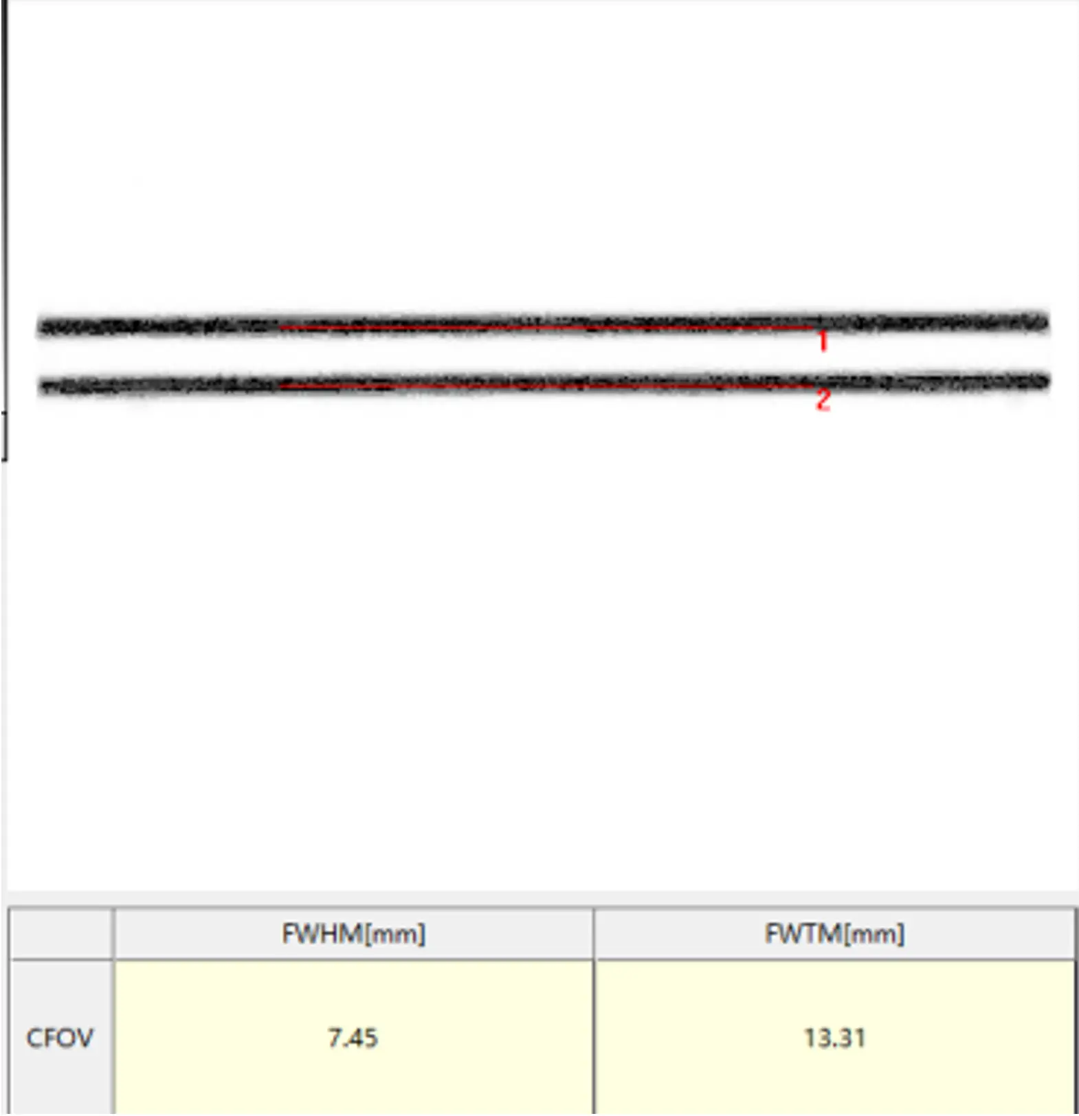 单光子发射X射线计算机断层成像系统注册-空间分辨率图像示例