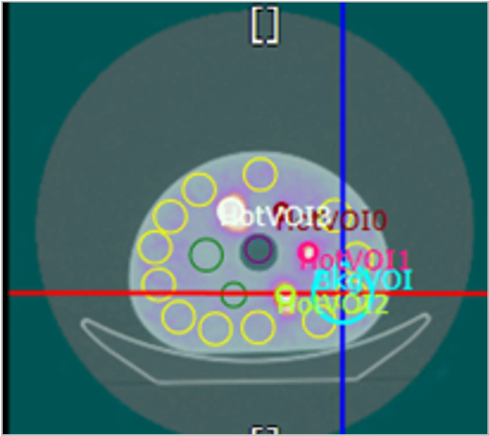 单光子发射X射线计算机断层成像系统注册-断层图像对比度示例