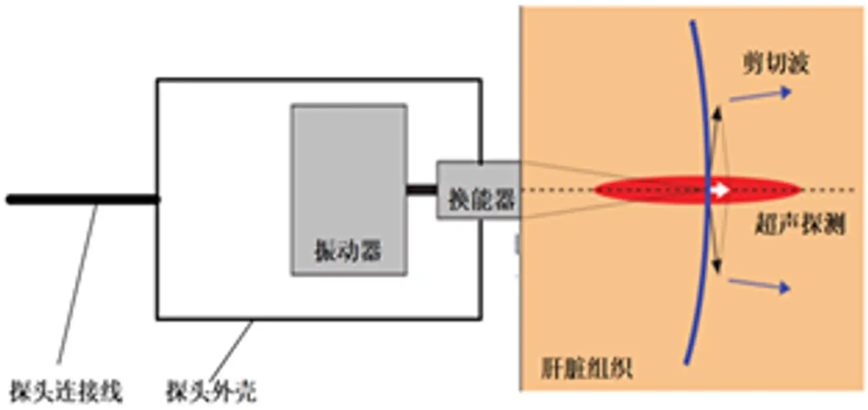 定量剪切波超声肝脏测量仪注册审查剪切波传播演示