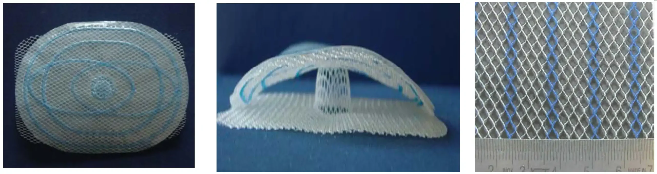 疝修补补片注册审查立体示意图1