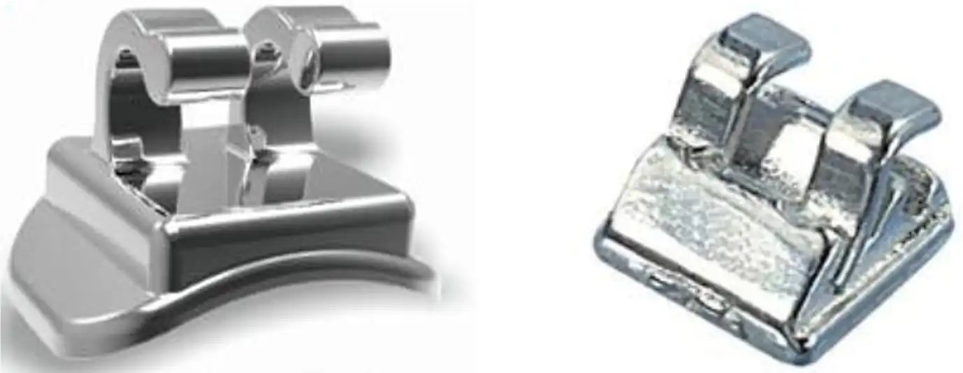 舌侧正畸托槽示意图 - 正畸托槽注册审查