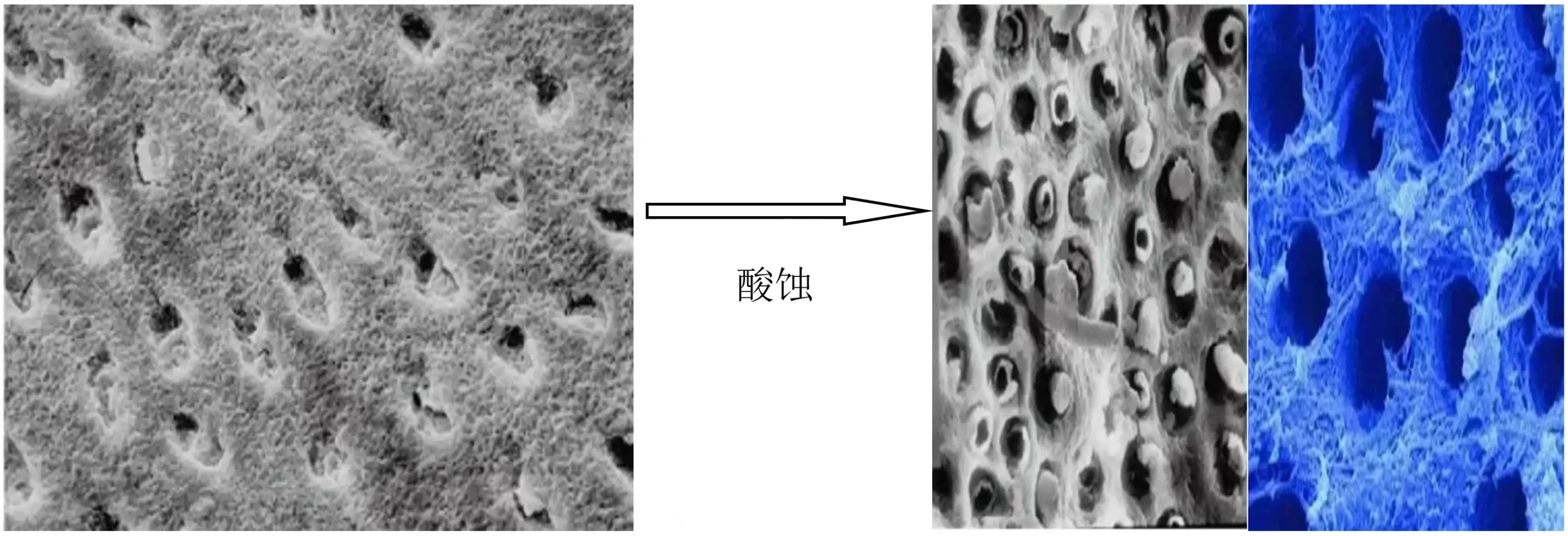 牙科用磷酸酸蚀剂注册审查--图2