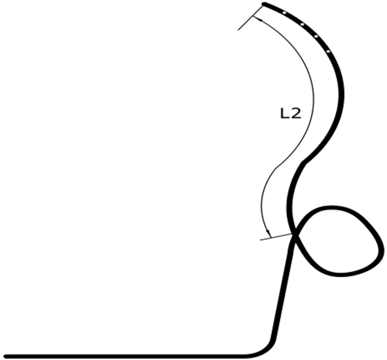 经鼻胆汁外引流管注册审查 - 逆α形引流管左