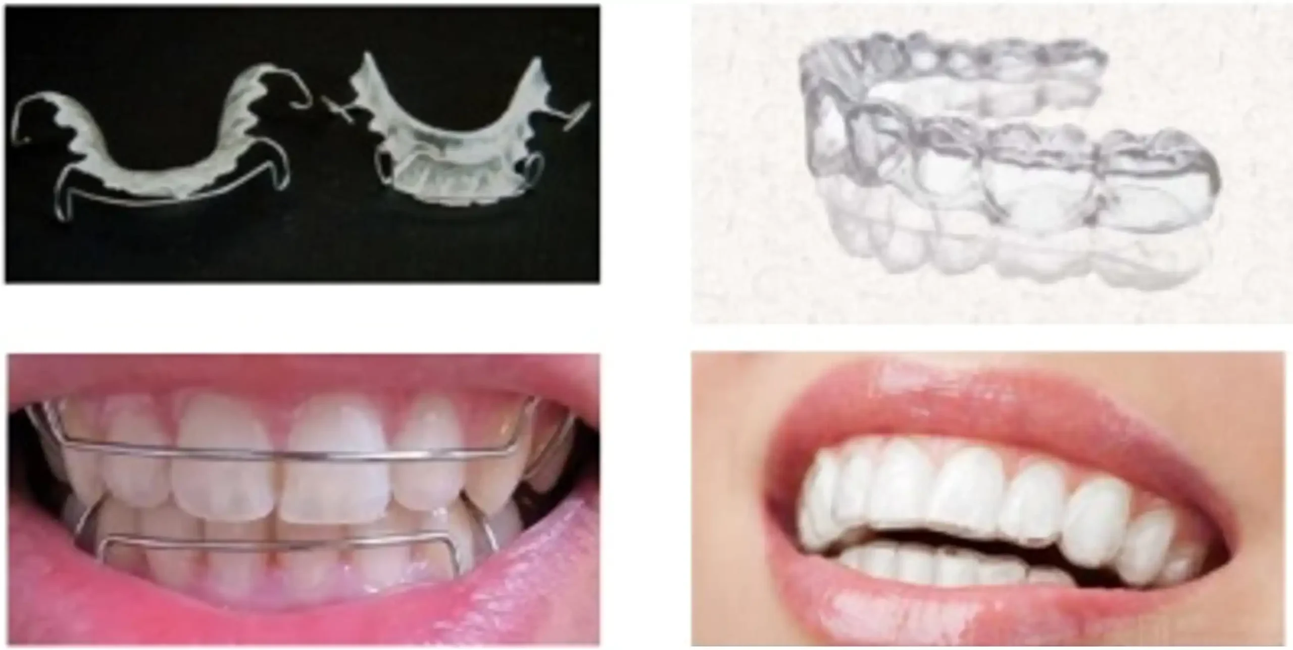 图1 保持器形式 口腔保持器注册审查