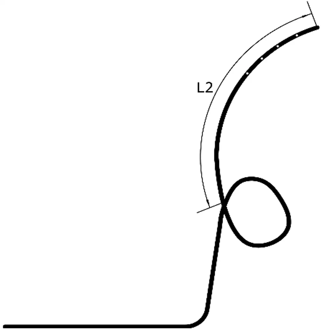 经鼻胆汁外引流管注册审查 - α形引流管右