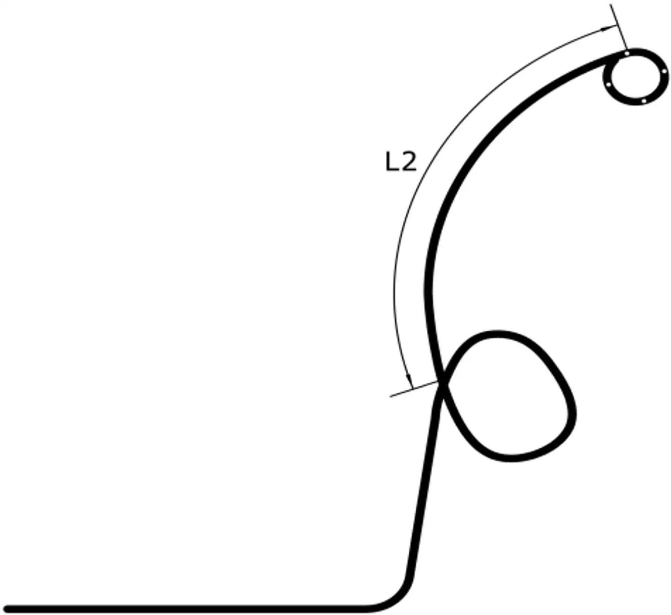 经鼻胆汁外引流管注册审查 - 猪尾α形引流管