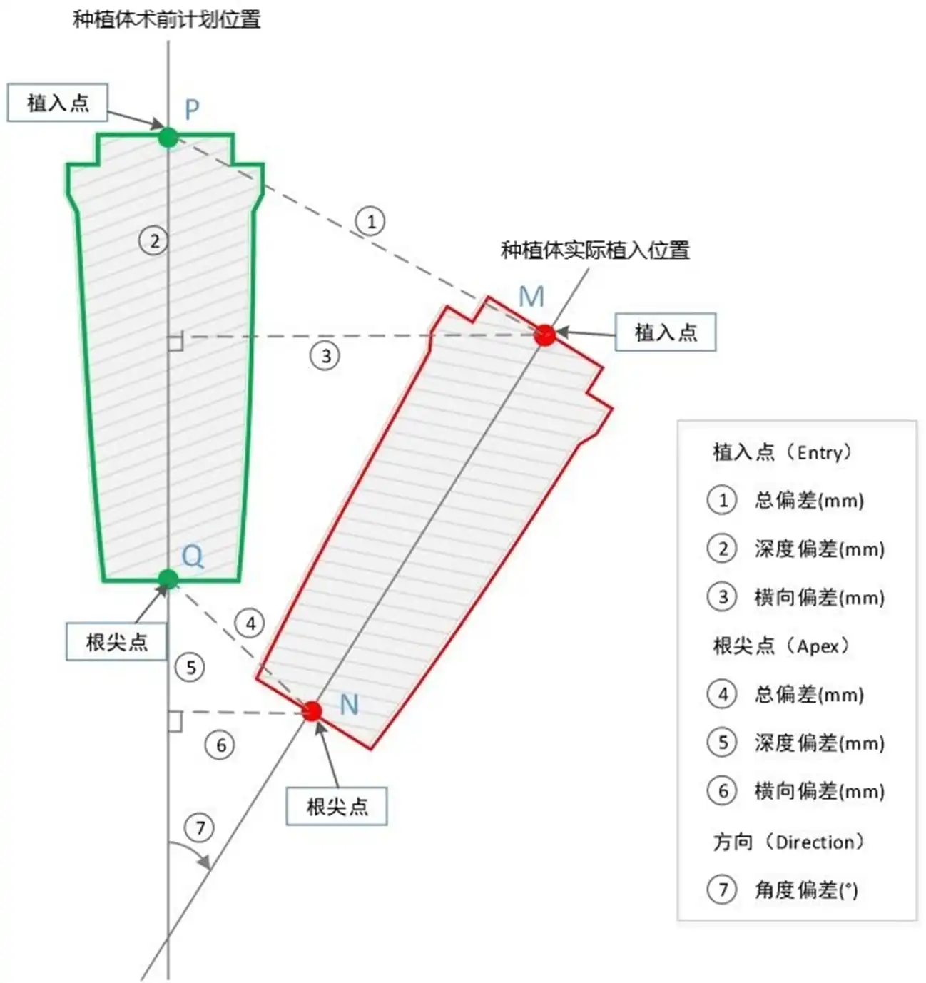 口腔种植手术导航定位系统同品种临床评价植入精度参数定义图