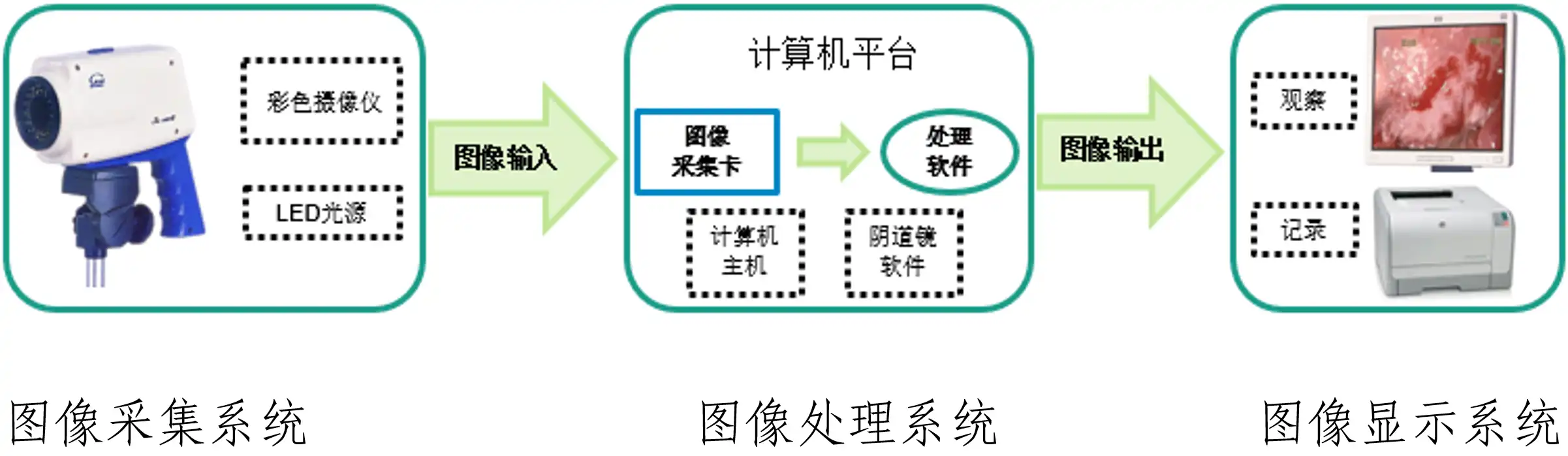 电子阴道显微镜注册审查图示:结构原理图