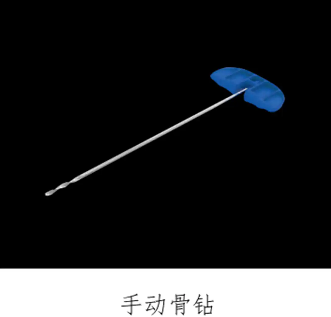 骨水泥套管组件注册审查涉及的椎体成形术组件结构示意图四