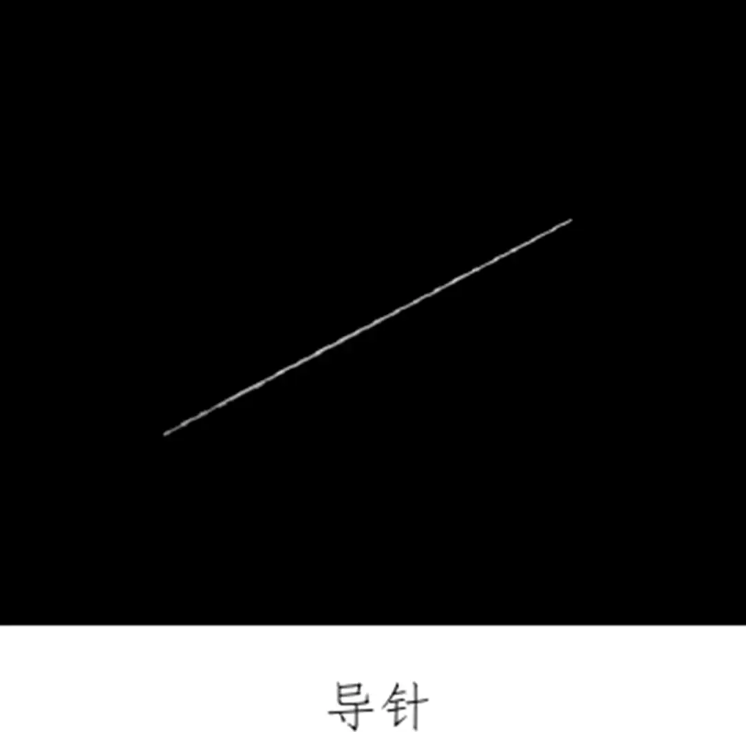 骨水泥套管组件注册审查涉及的椎体成形术组件结构示意图二