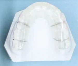 定制式正畸矫治器注册审查中的全口颌垫矫治器示例