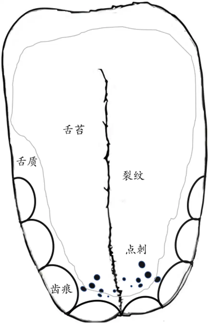 中医舌诊仪产品注册审查重点涉及的舌象图像特征示意图