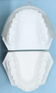 定制式正畸矫治器注册审查中的前庭盾示例
