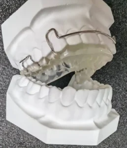 定制式正畸矫治器注册审查中的Activators肌激动器示例